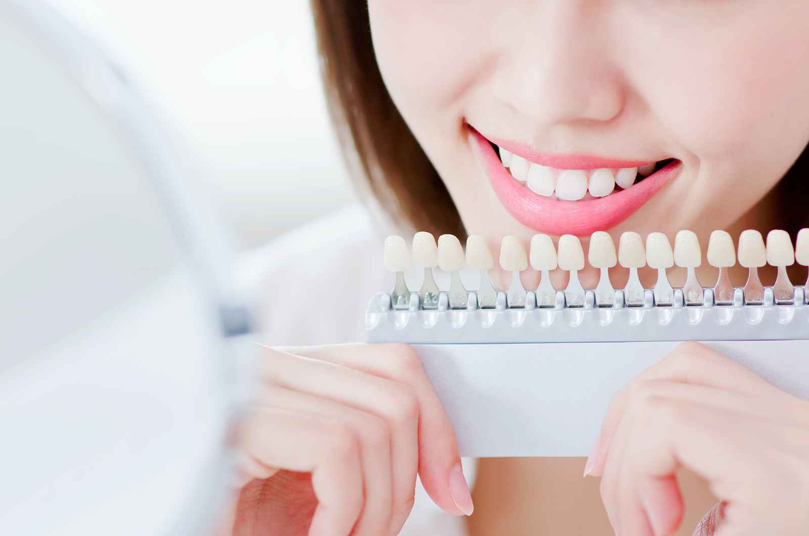 הלבנת שיניים לחתונה – האם זה שווה את זה?