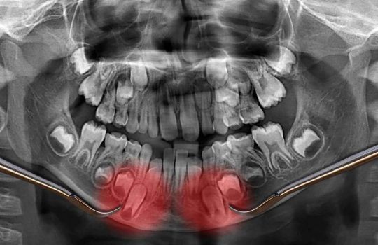 Mobile Dental CT Scans2